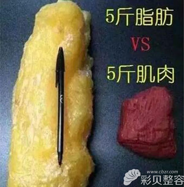 郑州吸脂塑形